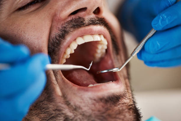 Best Emergency Denture Repair in Parachute, CO