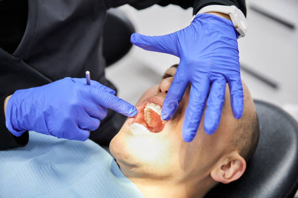 Best Emergency Treatment for Dental Infections or Abscesses in Parachute, CO